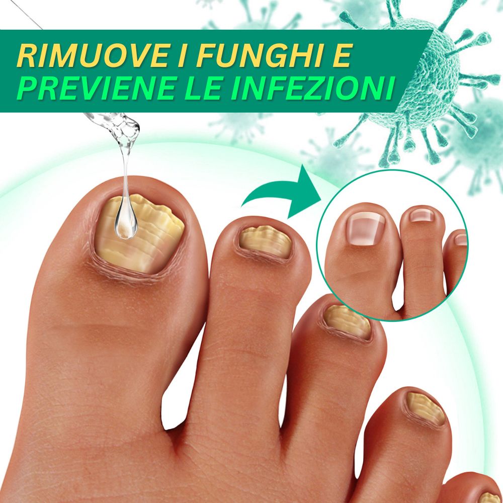 rimuove i funghi e previene le infezioni