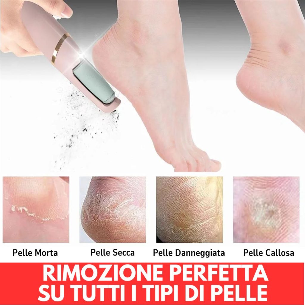 Rimuove in modo sicuro calli duri, pelle secca o screpolata e aree ruvide. Facile da usare su entrambi i piedi, dalla parte anteriore a quella posteriore: talloni, dita dei piedi e avampiede. Callus è dotato di due teste a rullo (una grossa e una fine) e due impostazioni di velocità, puoi personalizzare il trattamento in base alle tue esigenze, sia che tu debba fare un paio di ritocchi rapidi o preparare i tuoi piedi per indossare i tuoi sandali preferiti. Portatile e compatto, Ricaricabile e resistente all’acqua